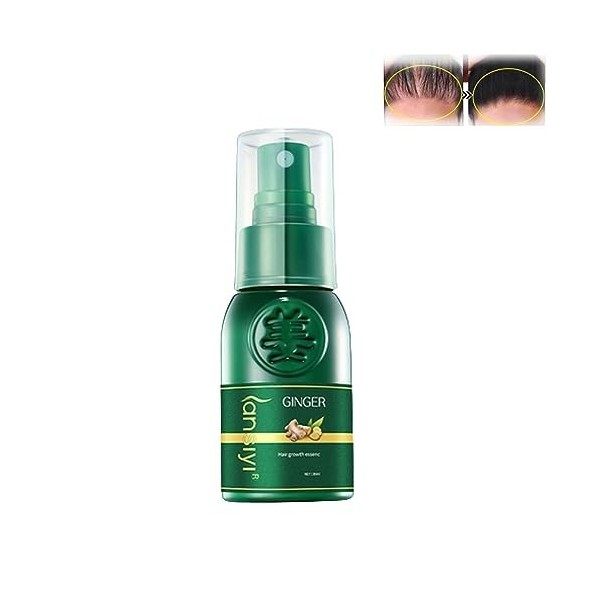 Oveallgo™ Shougagro Spray Japonais Pour La Croissance Des Cheveux, Oveallgo Spray Repousse Cheveux, Oveallgo™ Shougagro Japan