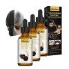 Meellop Anti Greying Hair Serum, Anti-Greying Hair Darkening Serum, Ganoderma Nutrient Natural Darkening Serum, Organic Ganod