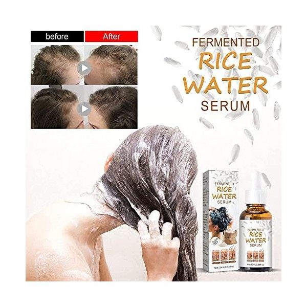 2pcs Fermented Rice Water Serum, Rice Water for Hair Growth Essence Anti-Hair Loss, Rice Water Hair Growth Serum for Thinning