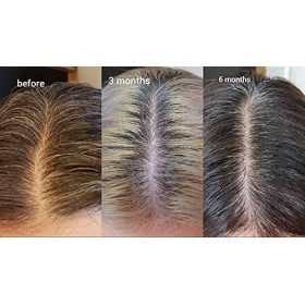 The Ordinary Multi-Peptide Hair Density Serum 60ml 