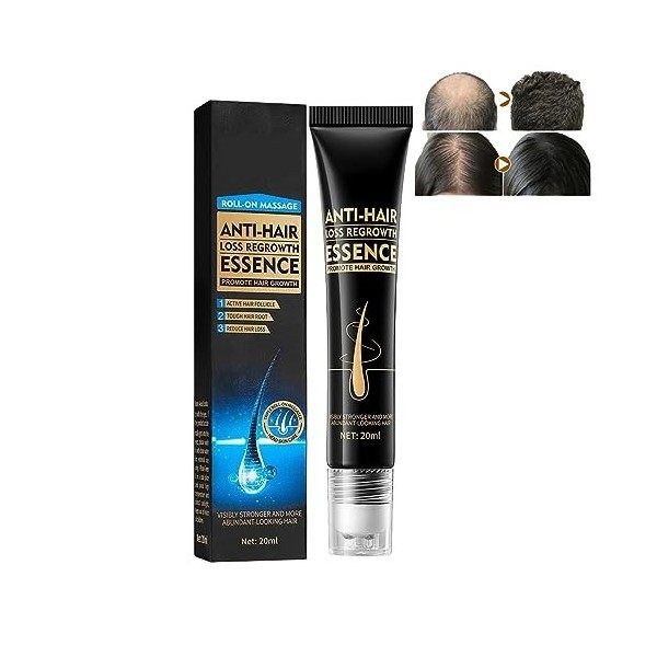 Essence De Massage À Bille Pour La Croissance Des Cheveux À La Biotine, Triple Masseur À Bille Pour La Croissance Des Cheveux