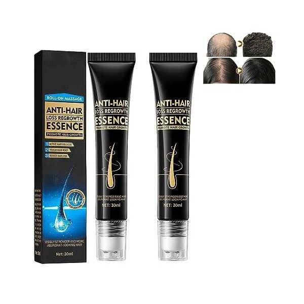 Essence De Massage À Bille Pour La Croissance Des Cheveux À La Biotine, Triple Masseur À Bille Pour La Croissance Des Cheveux