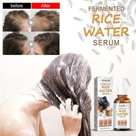 Eau De Riz Cheveux,Traitement Antichute,Sérum Anti Chute Cheveux,Hair Growth Serum,Fermented Rice Water Serum Hair Growth for
