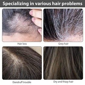 Darka Anti-Greying Hair Serum 3PCS Sérum anti-grisonnement des cheveux Anti Grey Hair Serum,Anti Greying Hair Serum Ganoderma