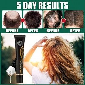 2PCS Organic Hair Stronger Serum Roller,Regrowth Organic Hair Sérum Roller,Sérum de pousse des cheveux,Biotin Hair Growth Ser