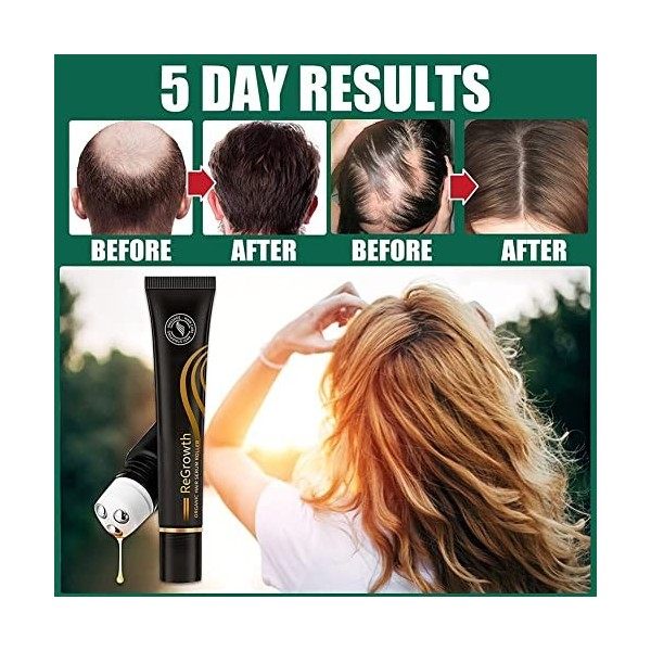 2PCS Organic Hair Stronger Serum Roller,Regrowth Organic Hair Sérum Roller,Sérum de pousse des cheveux,Biotin Hair Growth Ser