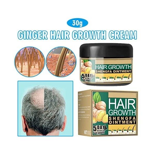 Kolarmo Natural Ginger Crème de croissance des cheveux pour homme et femme Traitement de perte de cheveux germinale 1 pièce 
