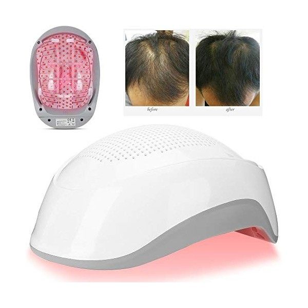 Casque de croissance des cheveux, Cap de croissance de cheveux de laser de puces lumineuses 180pcs pour le système dhommes e