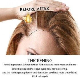 Soin Exfoliant Doux pour le Cuir Chevelu, Exfoliant et Nettoyant en Profondeur pour Soulager la Tension du Cuir Chevelu, équi