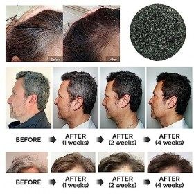 NELLN Spartan - Barre inversée for Cheveux Gris, Barre inversée for Cheveux Gris Spartiate, Shampoing for Barre inversée for 