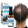 30 ml Croissance des cheveux pour hommes, Produits dépaississement des cheveux pour femmes, Traitement de la repousse des ch