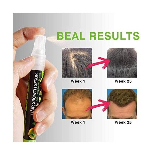 Jomewory Herbes pour la Croissance des Cheveux | Épaississement des Cheveux hydratant réparation à Base | 10 ML Herbal Hair E