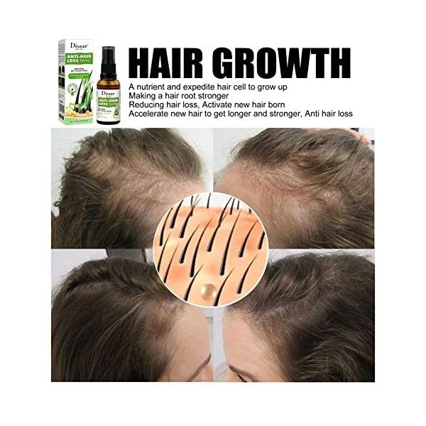 Spray hydratant pour la croissance des cheveux 30 ml - Spray épaississant pour cheveux fins | Traitements contre la perte de 