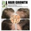 Spray hydratant pour la croissance des cheveux 30 ml - Spray épaississant pour cheveux fins | Traitements contre la perte de 