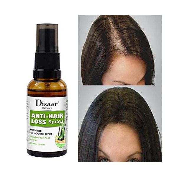 Jayehoze Spray hydratant pour la Croissance des Cheveux 30 ML,Spray épaississant pour Cheveux Fins | Traitement de la Repouss
