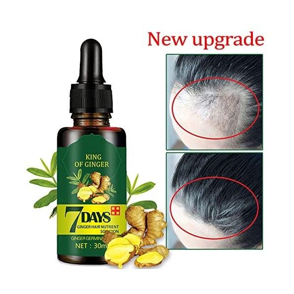 Hair Growth Serum, Hair Care Product, Hair Serum, Fast Hair Growth, Hair Growth & Hair Thickening,Stop Hair Loss, Grow Hair F