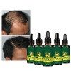 Sérum de Croissance de Cheveux, Huile Germinale de Gingembre, Anti Chute Cheveux Sérum de Cheveux,Perte de Cheveux et Cheveux