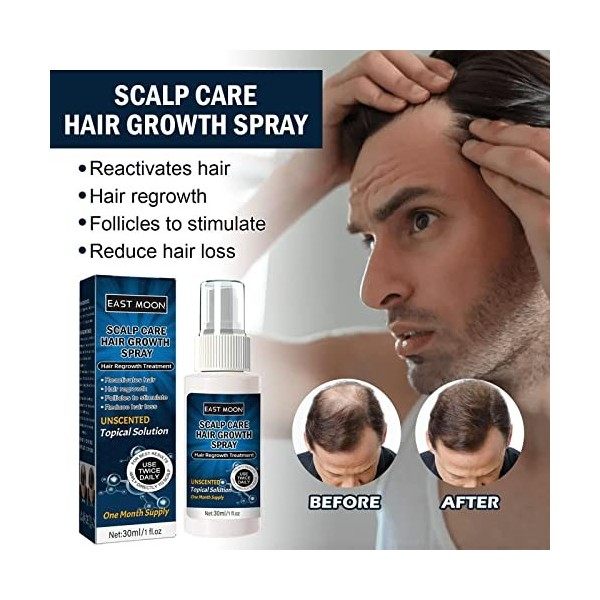 30ml Spray Pour La Croissance Des Cheveux Sér-um De Croissance Cheveux Huile Germinale Pousse Cheveux Très Rapide Cheveux Pou