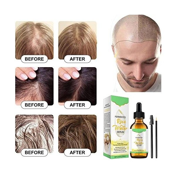 Rice Water Hair Growing Rice Water Hair Growth Serum, Anti-Hairs Loss sérum Hair Growth Suppléments Promoue plus épais, Fade 