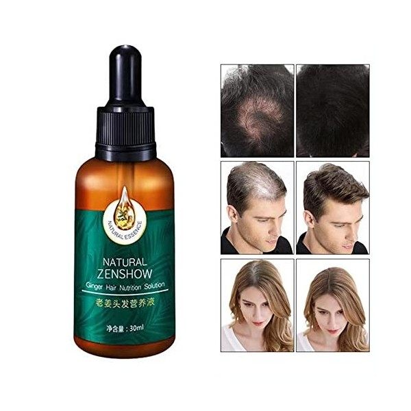 Ginger Germinal Oil, Hair Growth Oil, Hair Growth Serum, Ginger Germinal Essential Oil, Hair Loss Treatment Hair Care Hair Gr