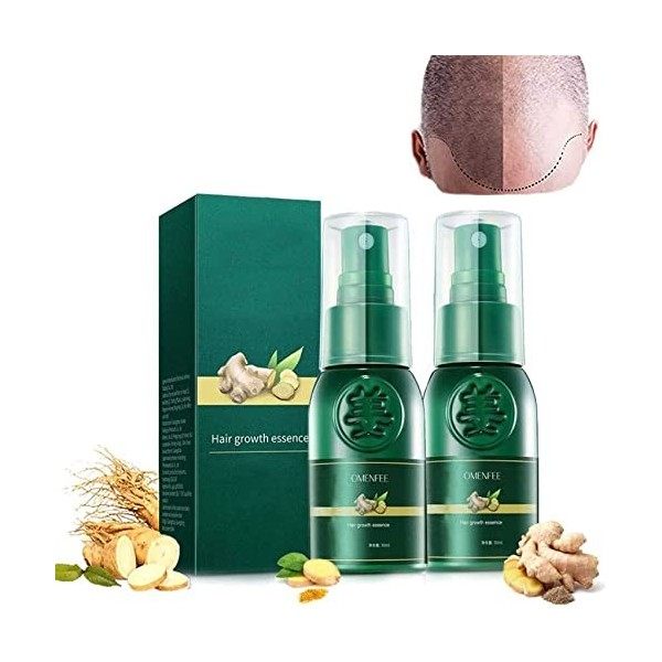 Hyungang Korea Ginseng Hair Regrowth Serum Spray, Hair Regrowth Serum Spray for Men and Women, 10 X Stimulate Hair Growthplus