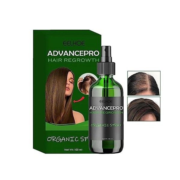 Repousse des cheveux,Spray pour la repousse des cheveux à lhuile de cuir chevelu hydratant 3,38 oz - Essence de soin du cuir