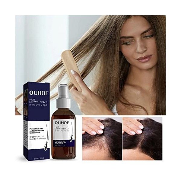 Spray de croissance des cheveux - Nourrit le cuir chevelu, répare les cheveux abîmés, renforce, épaissit et favorise la crois
