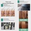 Traitement du cuir chevelu Lhuile capillaire, le sérum de régénération des cheveux favorise le sérum de perte de cheveux plu