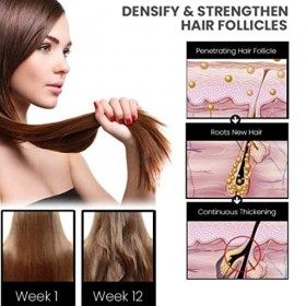 Fulenyi Spray pour la Croissance des Cheveux - Essence de Cheveux Polygone,Outils de Soins capillaires 30ML pour améliorer la