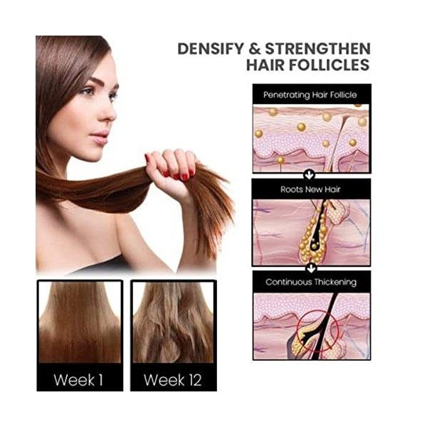 Fulenyi Spray pour la Croissance des Cheveux - Essence de Cheveux Polygone,Outils de Soins capillaires 30ML pour améliorer la