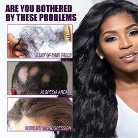 4 Pcs 30 Ml Spray de Régénération des Cheveux, épaississement des Cheveux Hydratant Dense Sérum Essentiel de Soin du Cuir Che