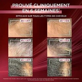 LOréal Paris - Sérum Anti-Chute Full Resist - Enrichi à lAminexil + Caféine + Arginine - Pour Cheveux Fragiles, Perte de Ch