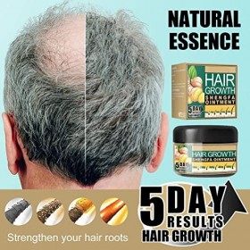 Revitalisant pour la Croissance des Cheveux au Gingembre Anti Pellicules Anti Démangeaisons Crème de Massage Hydratante pour 