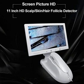 Analyseur de Cheveux de Diagnostic cutané, détecteur de follicules cutanés avec écran LCD HD de 11 Pouces, grossissement 200 