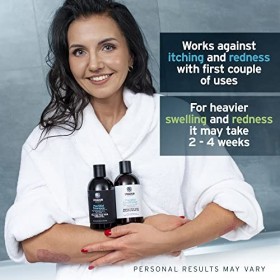 Shampoing pour Psoriasis - Traitement Naturel à la Boue de Tourbe sans Goudron de Houille Cancéreux. sans Sulfate, Démangeais