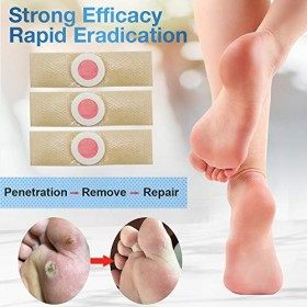 Anti Verrues, 24PCS Acrochordons Traitement Zero Verrue Traitement Verrues Plantaires, Détartrant Les Verrues Pour Les Mains 