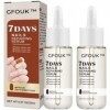 GFOUK Sérum de croissance et de renforcement des ongles 7 jours,Sérum de croissance et de force des ongles,Traitement de croi