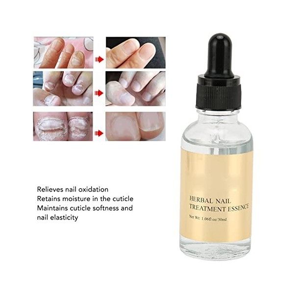 Renforcement des Ongles, 30 Ml de Solution de Traitement des Ongles à Base de Plantes Nourrissantes Hydratantes sans Danger p