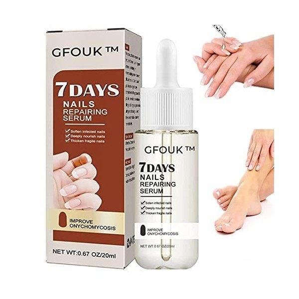 Sérum de croissance et de renforcement des ongles 7 jours, sérum de croissance et de renforcement des ongles, traitement de c