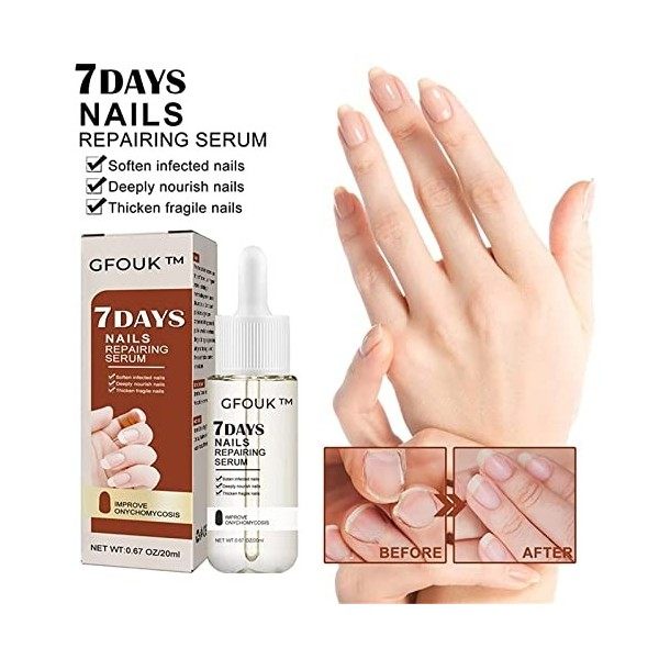 Sérum de croissance et de renforcement des ongles 7 jours, sérum de croissance et de renforcement des ongles, traitement de c