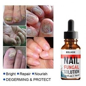  30ml Mycose Ongles des Pieds, Traitement Mycose Ongle Pied, Émollients Ongles, Solution pour Les Ongles Décolorés, Antifong