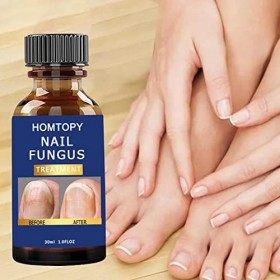 Kit de réparation dongles pour ongles naturels fissurés - Solution de mycoses des ongles pour ongles épais,Le durcisseur do