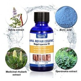 Traitement ongles,Champignon Ongles Traitement, Traitement Ongles, Favorise la Repousse dOngles Sains