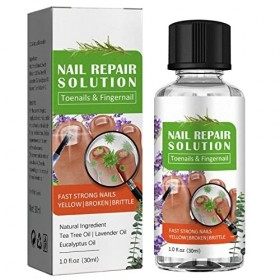 gaoqiao Solution Extra-Forte Contre Les Champignons des Pieds - Solution de mycoses des Ongles pour Les Ongles épais | Champi