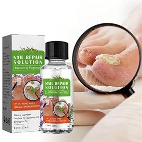 gaoqiao Solution Extra-Forte Contre Les Champignons des Pieds - Solution de mycoses des Ongles pour Les Ongles épais | Champi