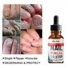 30ml Mycose Ongles des Pieds,Mycose Ongle,Traitement Mycose Ongle Pied,Traitement Ongles,Solution pour Les Ongles Décolorés, 