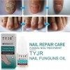 Nuobk Anti Fongique, Mycoses Nails, Traitement Antifongique Des Ongles. Champignon Solution Contre Les Infections Fongiques O