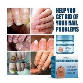 Crème Ongles - Soin des Ongles Renouvellement des Ongles Crème Réparatrice des Ongles des Orteils,Crème de renforcement des o