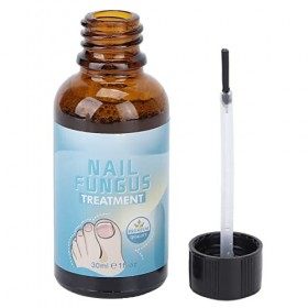 Traitement des champignons des ongles des orteils, restauration de la couleur des ongles, léger, portable, sûr, traitement de