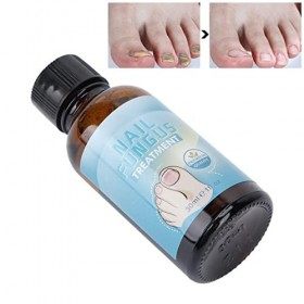 Traitement des champignons des ongles des orteils, restauration de la couleur des ongles, léger, portable, sûr, traitement de